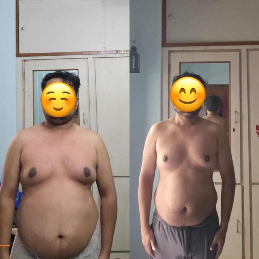 Abdominal Fat Reduction