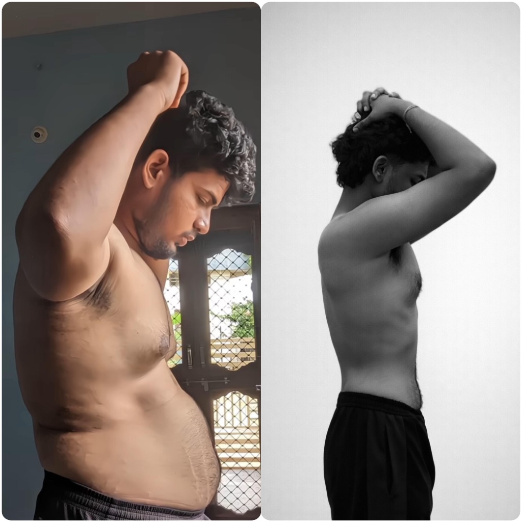 Abdominal Profile Fat Shred